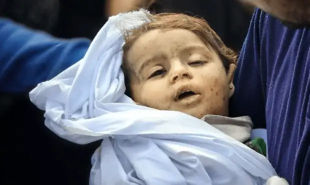 آخرین آمار از شهدا و مجروحان غیرنظامی تجاوز دشمن/ وزارت بهداشت اعلام کرد