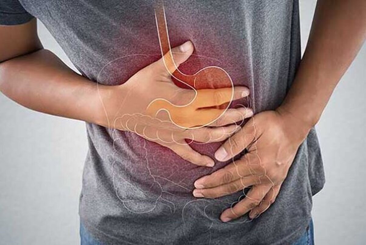 چند توصیه ساده برای کاهش علائم رفلاکس و سوزش سر دل