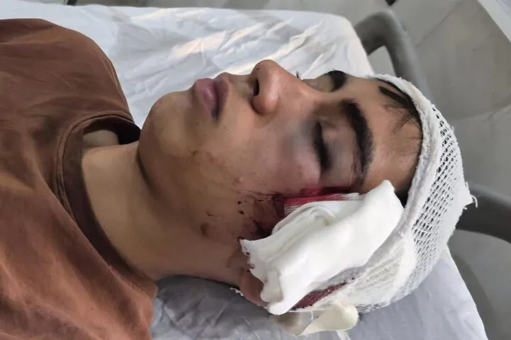 حادثه مصدومیت شدید دانش آموز دهبکری بم خبر ساز شد