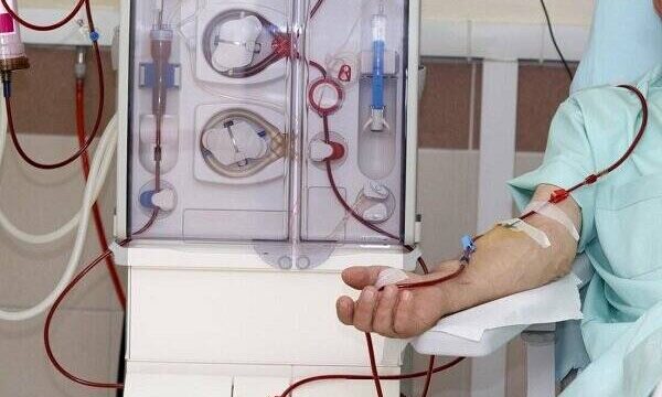 معرفی ۵ ماده غذایی برتر برای جلوگیری از سنگ کلیه