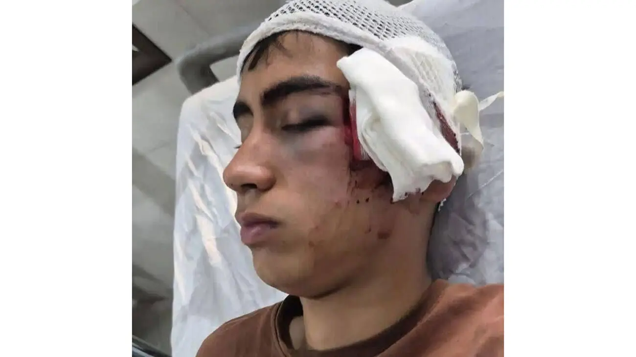 معلم با دسته صندلی به سر و صورت دانش آموز کوبید آموزش و پرورش بم پیگیر برخورد با متخلفان است