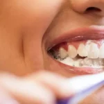 ۳ خطری که سلامت دندان هایتان را تهدید می کند